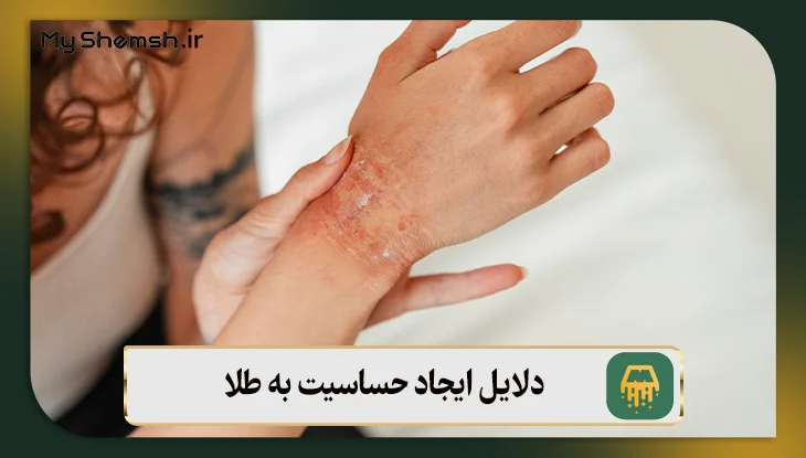 دلایل ایجاد حساسیت به طلا